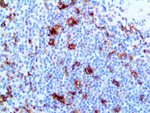 IHC of CD13 Rmab on an FFPE Tonsil Tissue